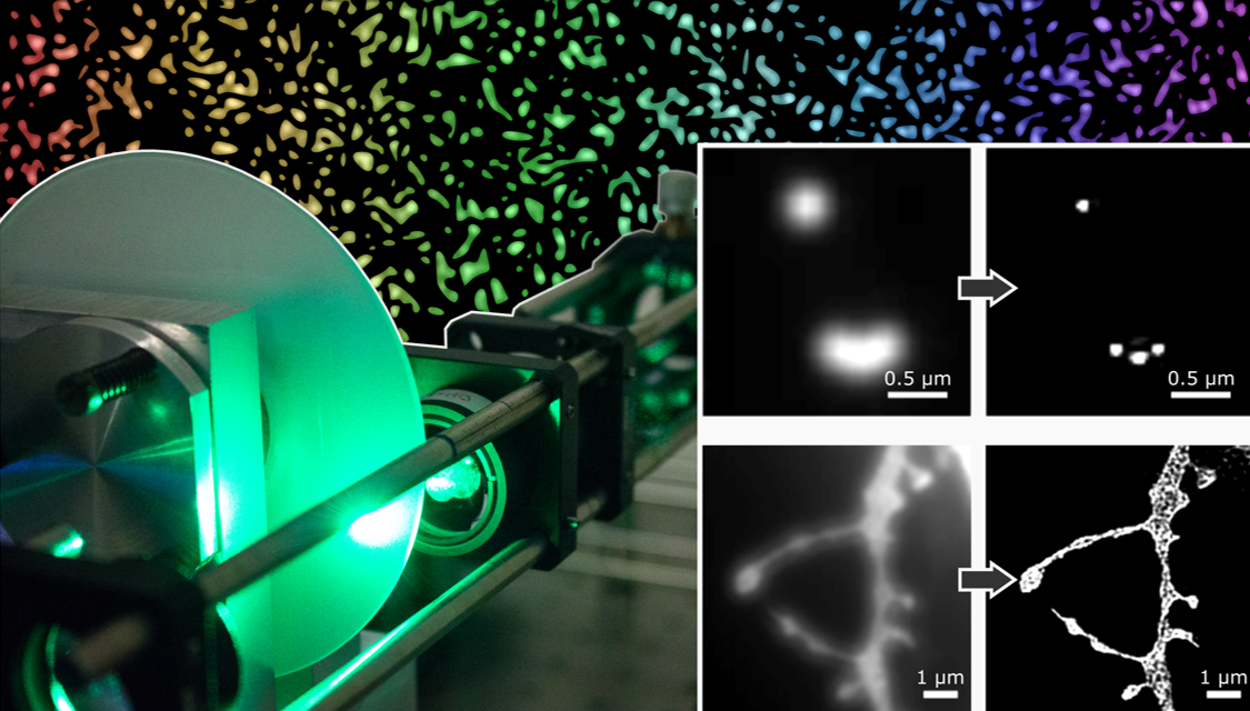 Mikroskopietechnik für schnelle und nanometergenaue 3D-Darstellung lebender Zellen